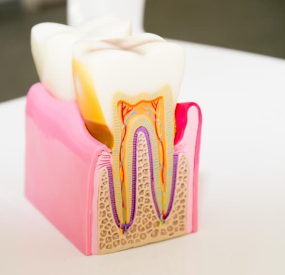 tooth model